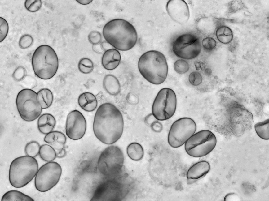 Kichererbsen-Stärkekörner unter dem Mikroskop in planpolarisiertem Licht bei x400 Vergrößerung. 