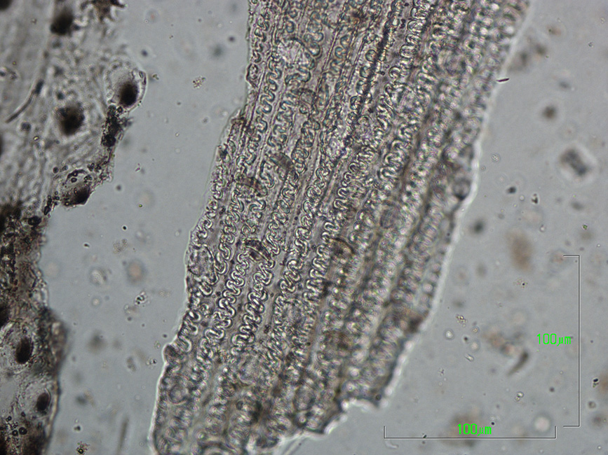 Phytolithen aus mehrzelligen Blütenständen von Gräsern in planpolarisiertem Licht bei x200 Vergrößerung. 